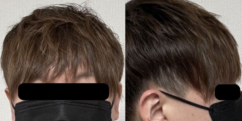 アフター:3ステップでセット後の前髪