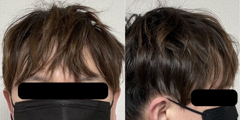 ビフォー:前髪が割れた状態(おでこ広い・軟毛メンズ)